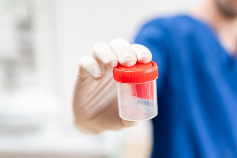 Ematuria le cause del sangue nelle urine Biomedical Diagnostic Center Laboratori Analisi Ematuria le cause del sangue nelle urine Biomedical Diagnostic Center Laboratori Analisi
